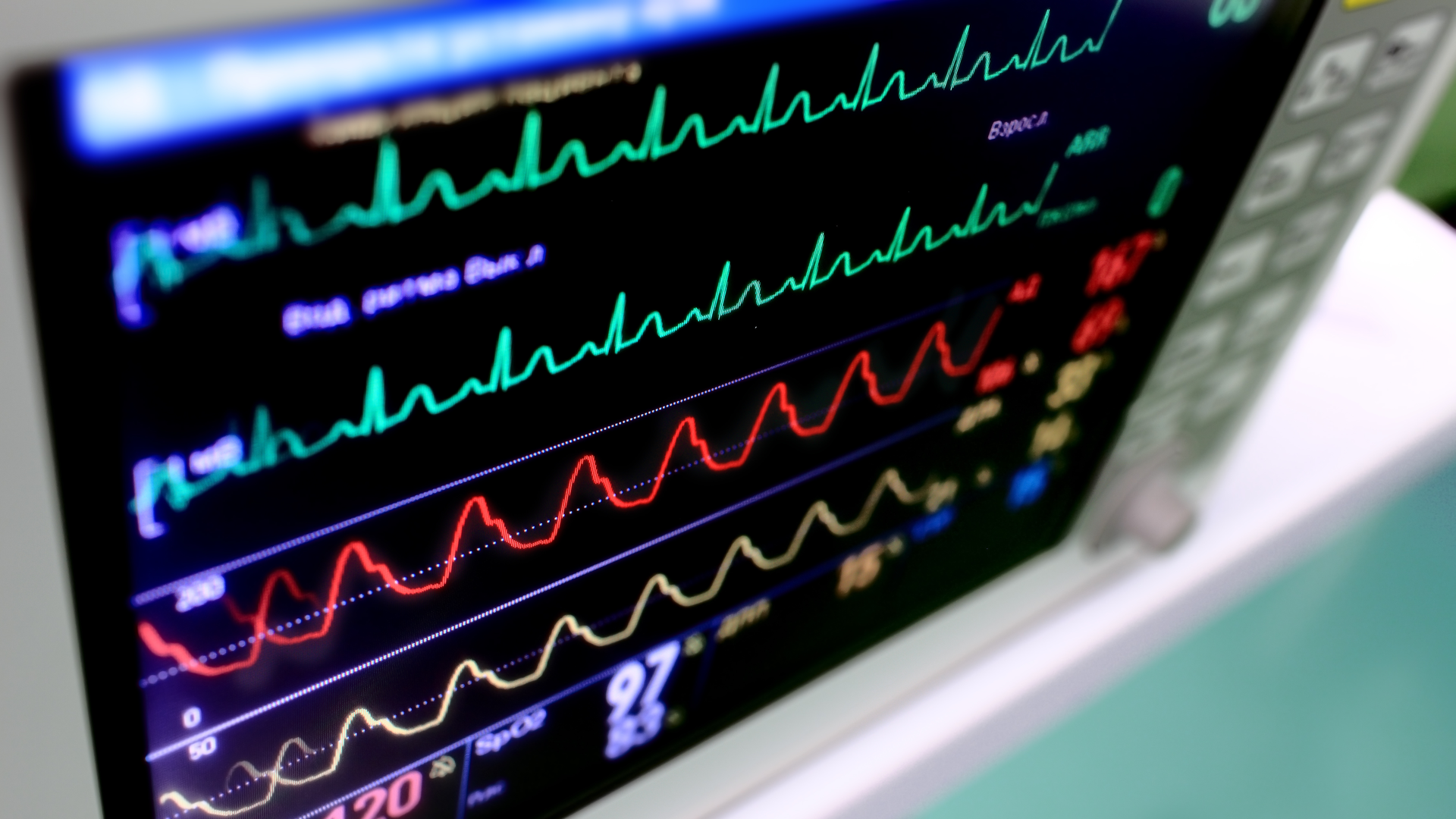 Oscilloscopes quickly measure live information or data, not sampling information like other equipment currently used to diagnose vehicle problems. This allows the technician reading the information to see and know exactly what is happening, when it happens.