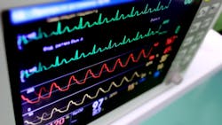 Oscilloscopes quickly measure live information or data, not sampling information like other equipment currently used to diagnose vehicle problems. This allows the technician reading the information to see and know exactly what is happening, when it happens. Oscilloscopes quickly measure live information or data, not sampling information like other equipment currently used to diagnose vehicle problems. This allows the technician reading the information to see and know exactly what is happening, when it happens.